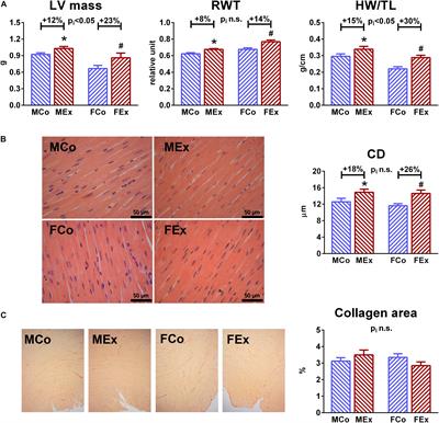 Sex Differences in Morphological and Functional Aspects of Exercise-Induced Cardiac Hypertrophy in a Rat Model